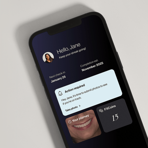FXOnTrack-App-Feature-Image